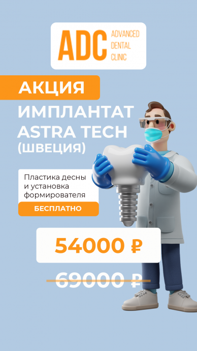 Имплантат Astra Tech (Швеция) по специальной цене всего 54000 рублей