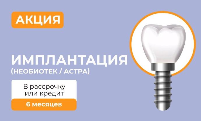 Имплантация NeoBiotech или Astra в рассрочку или кредит на 6 месяцев!